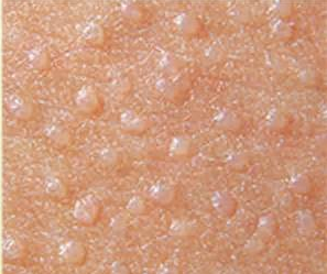 ������Ƥ��ҽԺ���Ʊ�ƽ�����